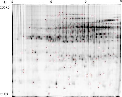 Proteomic responses of two spring wheat cultivars to the combined water deficit and aphid (Metopolophium dirhodum) treatments